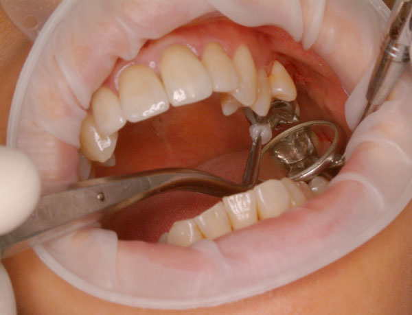 images/dentysta6.jpga0c8d.jpg